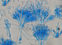 Aspergillus